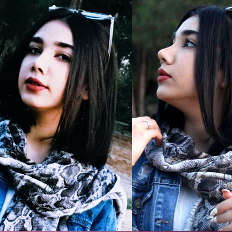 بهترین جراح بینی گوشتی